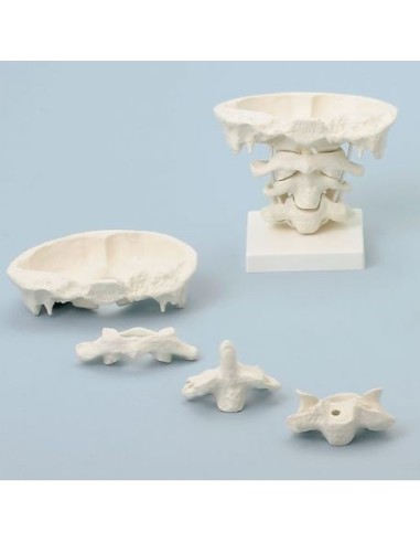 Erler Zimmer, skull joint model, twice enlarged, on base, decomposable into 4 parts 4083