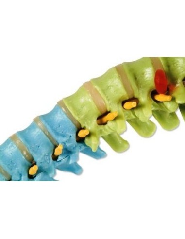 3B Scientific, Colonna vertebrale flessibile didattica a colori con tronchi del femore A58/9