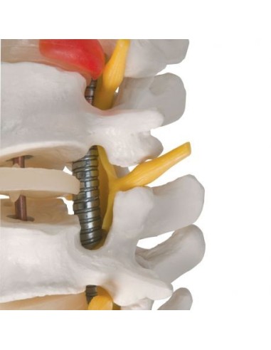 3B Científica, Columna vertebral flexible muy robusta con troncos de fémur A59/2