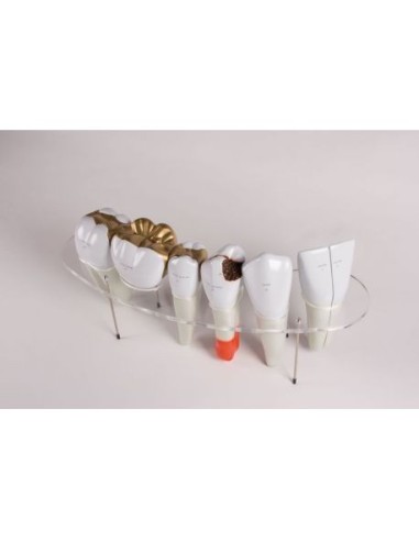 Erler Zimmer, serial anatomical model of dental morphology, magnified 10-fold R10125