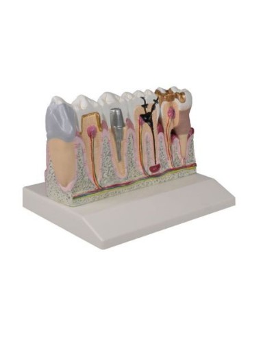 Erler Zimmer, anatomical model of teeth, magnified 4 times D250