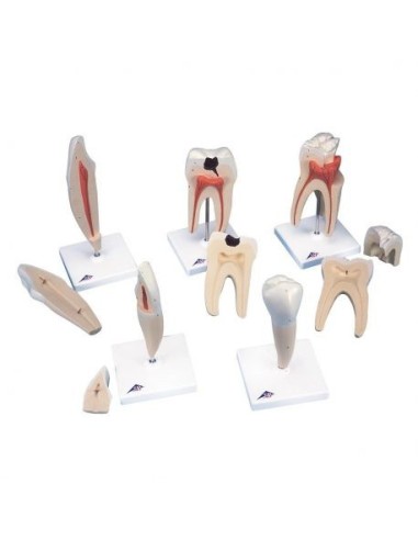 3B Scientific, ensemble complet de dents, 5 modèles anatomiques D10