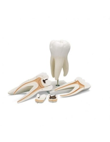 3B Scientific, three-root upper molar tooth model, in 5 parts D15