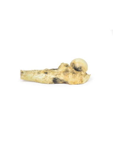 Osteosarcoma of the femur - Erler Zimmer 3D anatomy Series MP2116