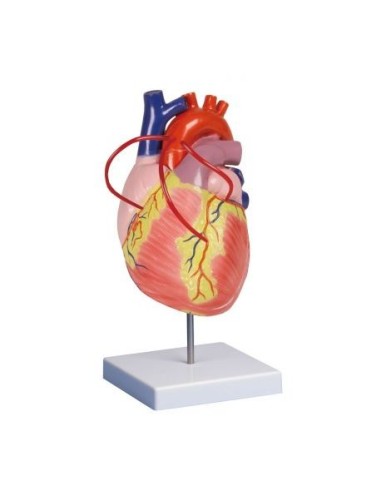 Erler Zimmer, anatomical model of heart with bypass, enlarged twice, decomposable into 2 parts G206