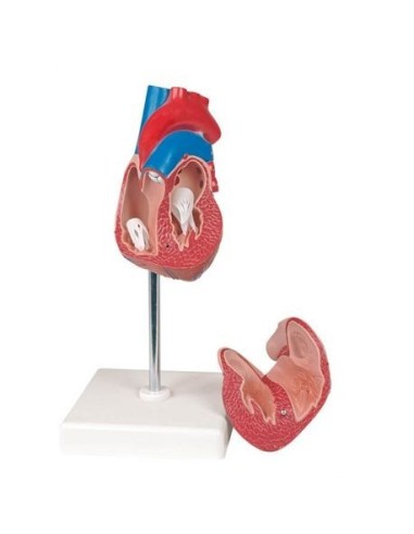 Erler Zimmer, anatomisches Modell eines Herzens mit Hypertrophie, in 2 Teile zerlegbar G104