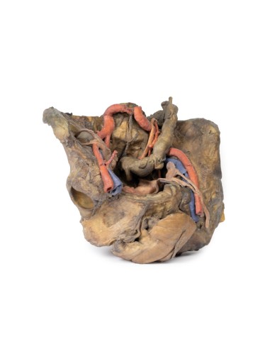 Deep dissection of the female pelvis - Erler Zimmer 3D anatomy Series MP1141