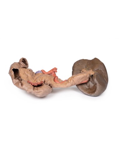 Dissezione di Milza e pancreas - Erler Zimmer 3D anatomy Series MP1135