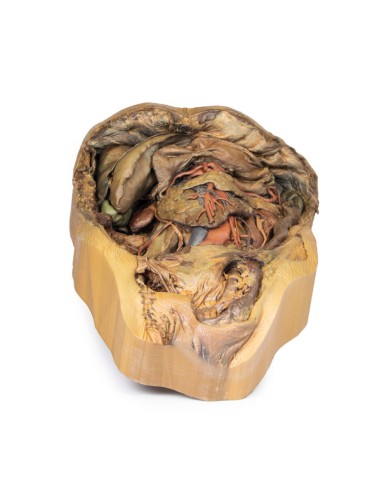 Dissection of the abdomen with inguinal hernia - Erler Zimmer 3D anatomy Series MP1133