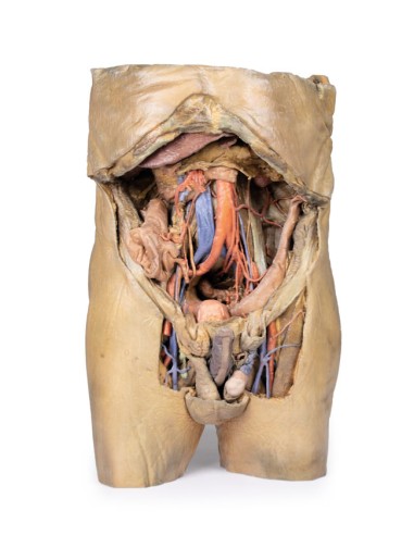 Dissection of the abdomen with bilateral hernias - Erler Zimmer 3D anatomy Series MP1130