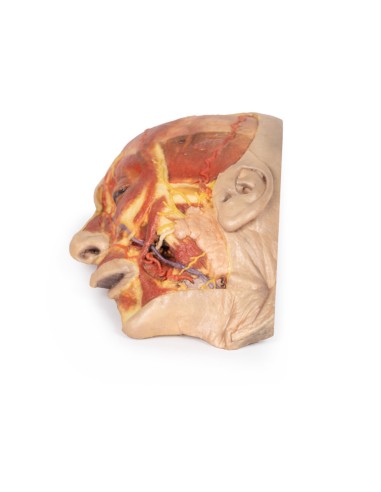 Surface dissection of the face - Erler Zimmer 3D anatomy Series MP1108