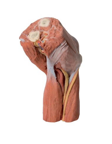 Cubital fossa: muscles, major nerves, and brachial artery - Erler Zimmer 3D anatomy Series MP1755