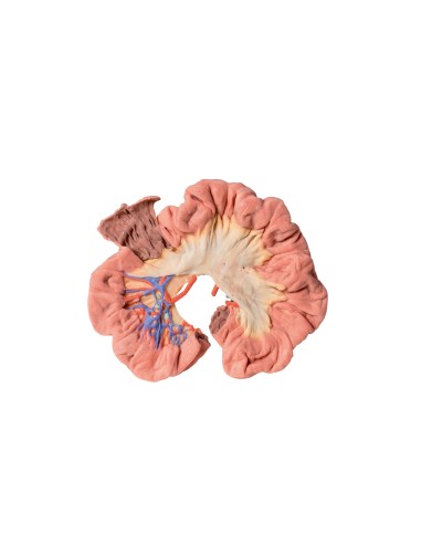 Intestine, portion of hilum - Erler Zimmer 3D anatomy Series MP1725